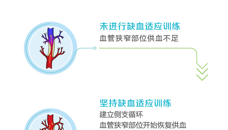 缺血预适应训练仪， 心脑血管病预防新技术