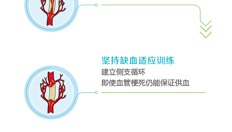 缺血预适应训练仪， 心脑血管病预防新技术