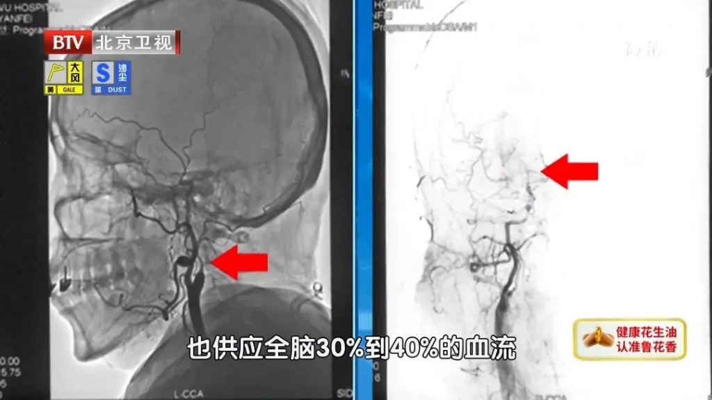 每天多做一项训练，打开脑卒中的“自救开关”！早练早受益，没病也能做~