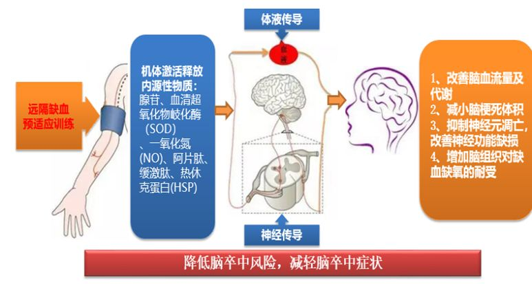 健康丹东-“缺血训练不放松，新招防治脑卒中” 暨卒中俱乐部公益宣教义诊大会顺利举行 