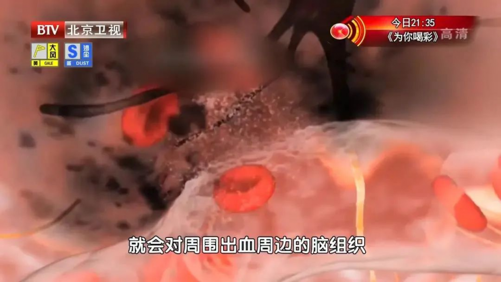 每天多做一项训练，打开脑卒中的“自救开关”！早练早受益，没病也能做~